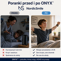 ONYX™ Budzik Wibracyjny dla osób, które przesypiają każdy alarm